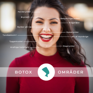 Botox, områder der kan behandles og hjælpes med Botox i ansigtet.